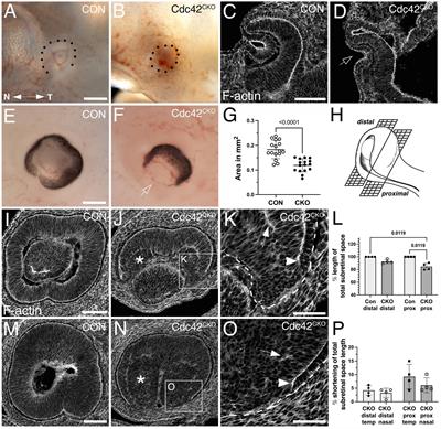 Loss of Cdc42 causes abnormal optic cup morphogenesis and microphthalmia in mouse